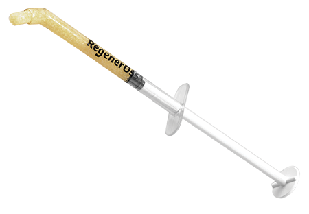 RegenerOss® Allograft Putties